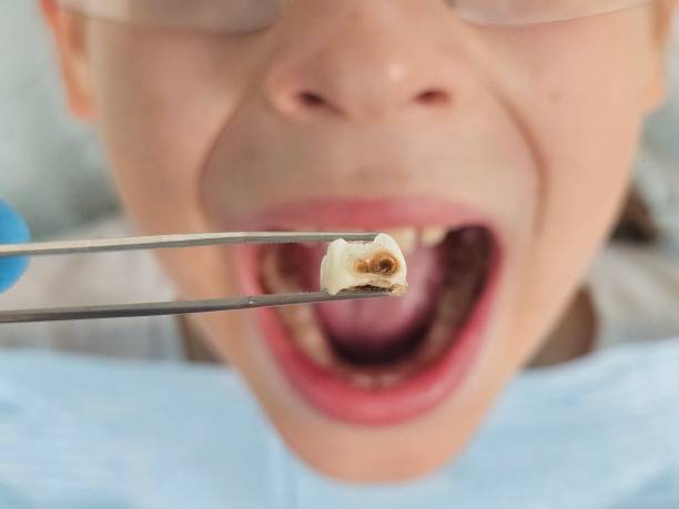 Best Emergency Gum Pain Relief  in Natchitoches, LA