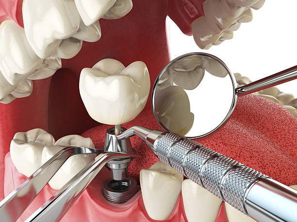 Best Emergency Tooth Extraction  in Natchitoches, LA
